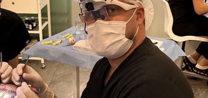 Дивак трансплантація волосся