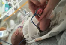 У Львові врятували передчасно народжену дівчинку з Тернополя з важкою асфіксією